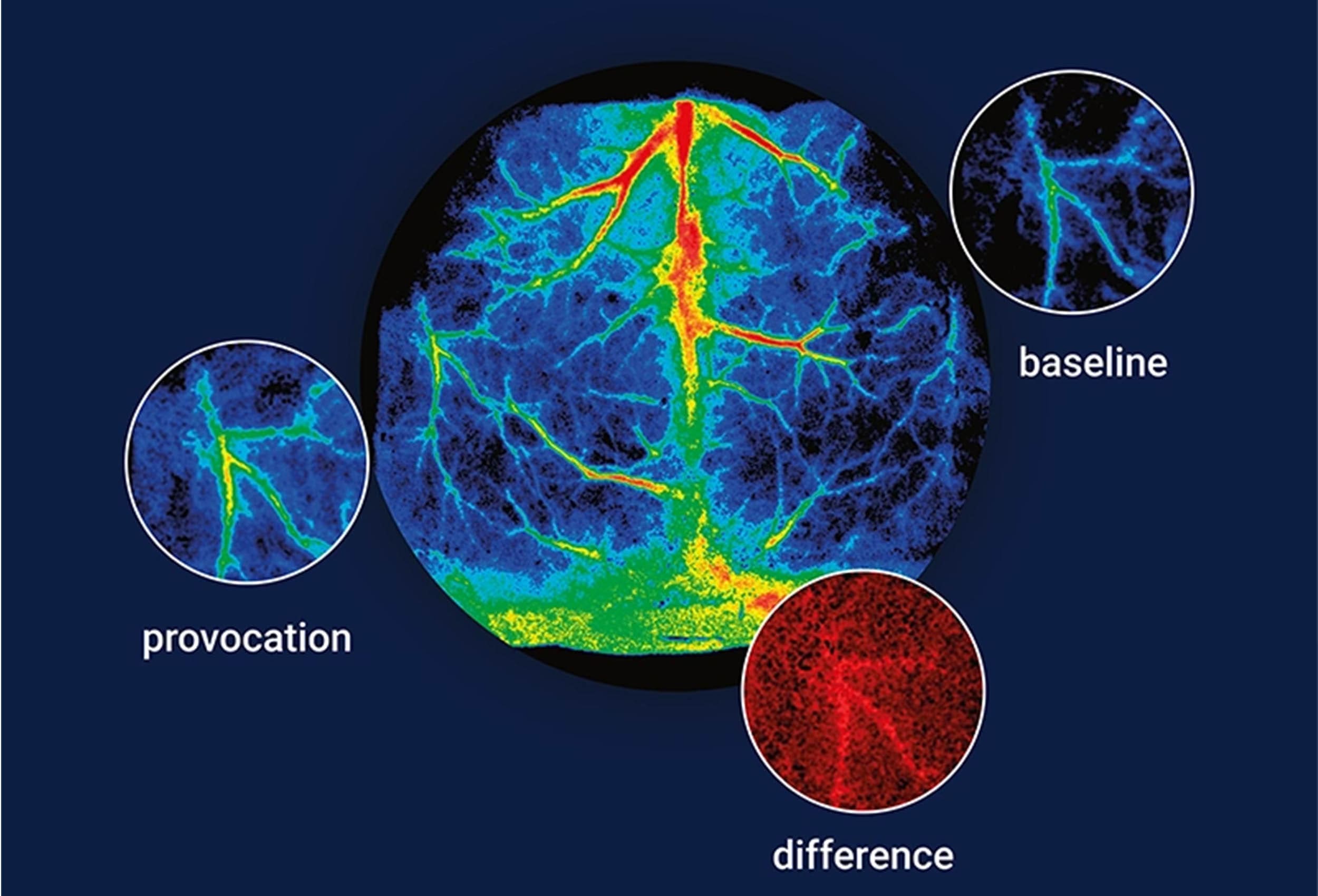 Blood Perfusion Imagers